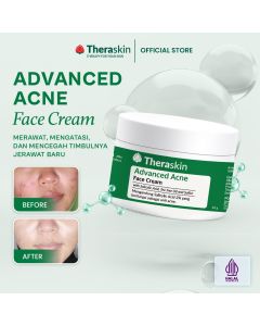 Theraskin Advanced Acne Face Cream