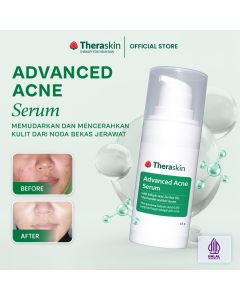 Theraskin Advanced Acne Serum