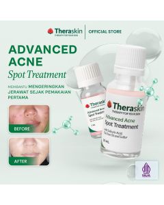 Theraskin Advanced Acne Spot Treatment 5 ml