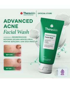 Theraskin Advanced Acne Facial Wash 100ml