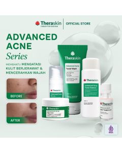 Theraskin Advanced Acne Series